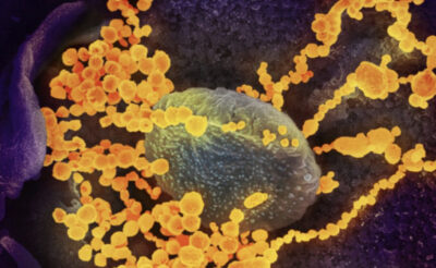 An electron microscope image shows SARS-CoV-2 (round gold objects), which causes COVID-19, emerging from cultured cells. Image courtesy of the National Institute of Allergy and Infectious Diseases.