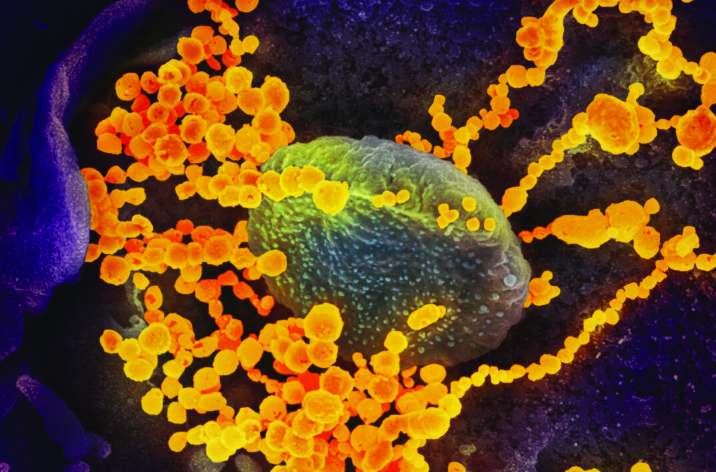 An electron microscope image shows SARS-CoV-2 (round gold objects), which causes COVID-19, emerging from cultured cells. National Institute of Allergy and Infectious Diseases screenshot.
